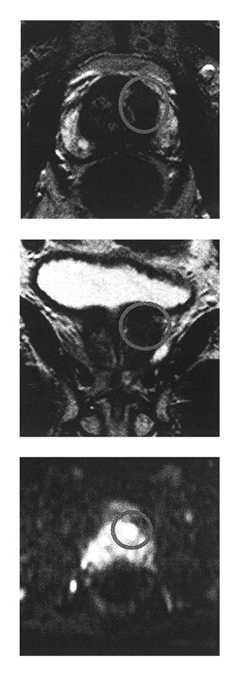 2012年11月22日_MRI画像